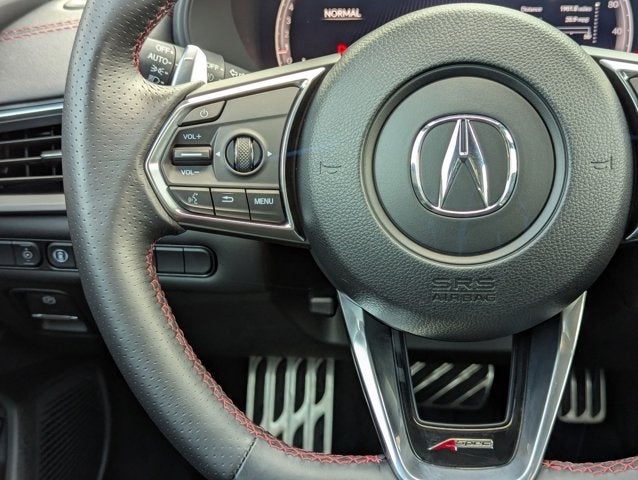 2025 Acura TLX w/A-Spec Package